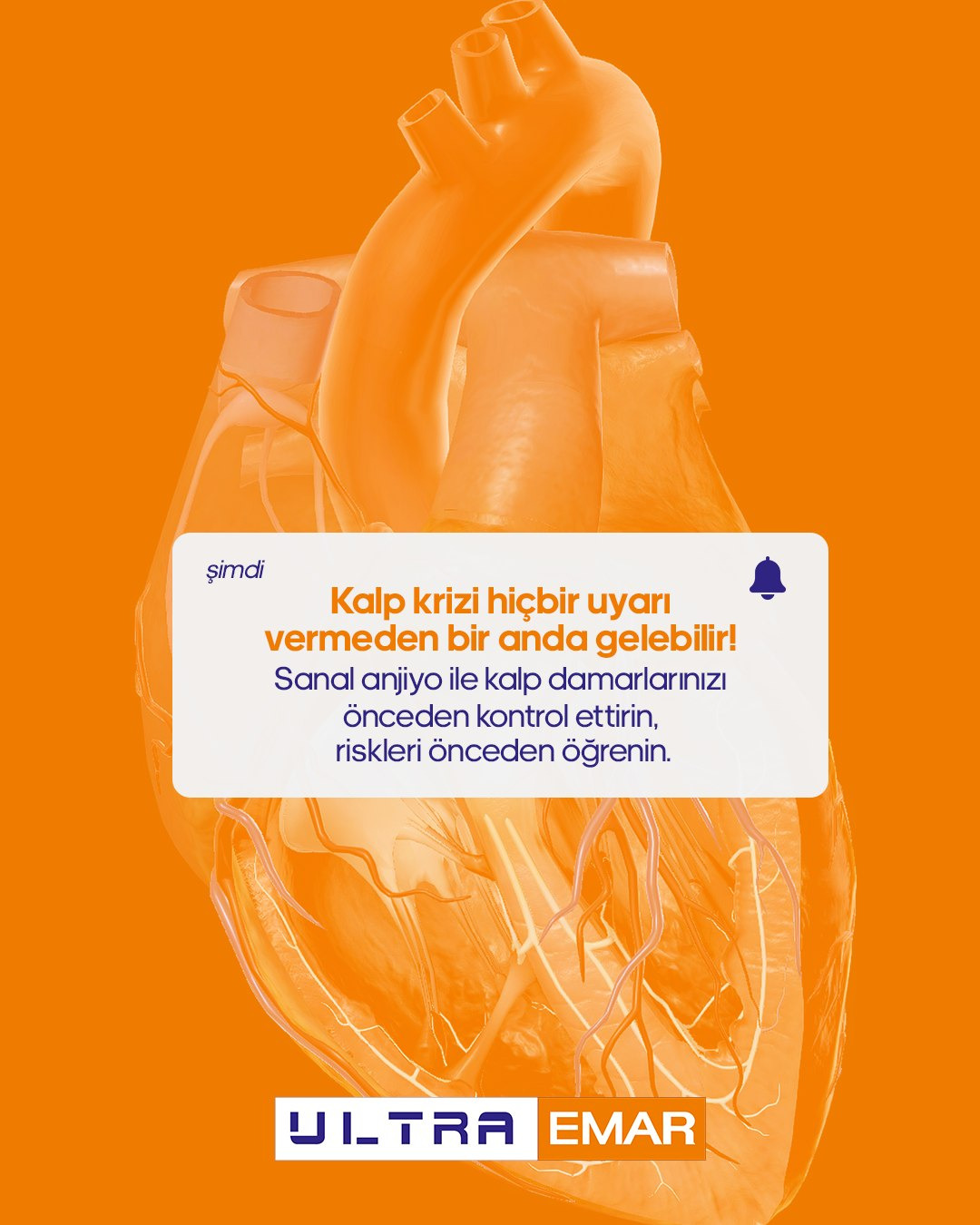 Koroner BT Anjiyografi (Sanal Anjiyo)